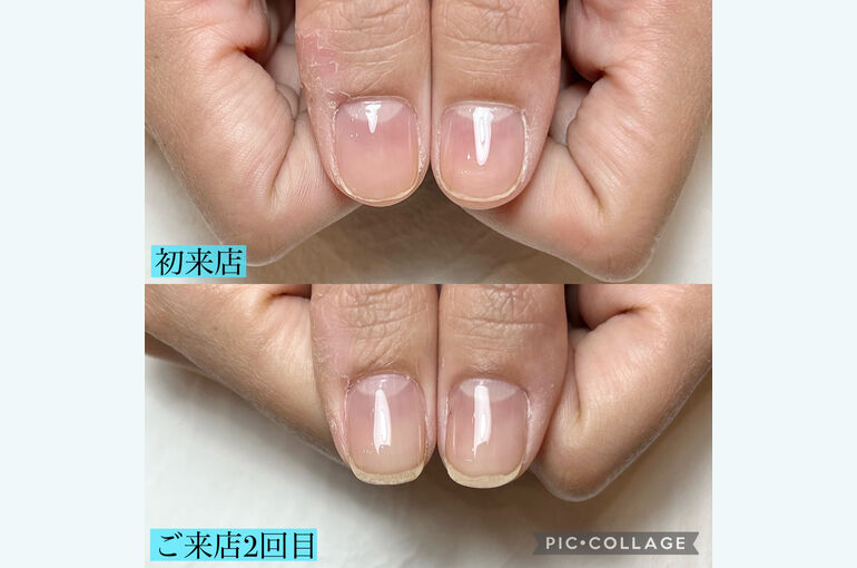 D32A914D-00DF-4D3B-A4EB-75E18F1591E3