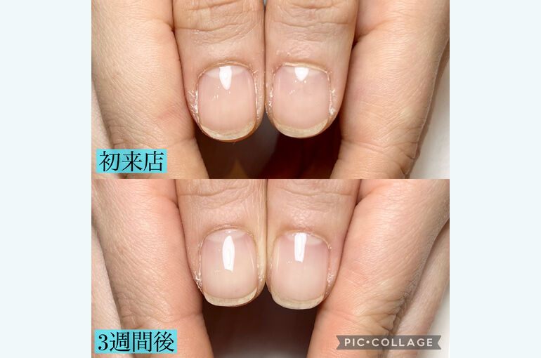 BF9C20D3-3DEF-44F9-B5A9-35A4A33E09E4